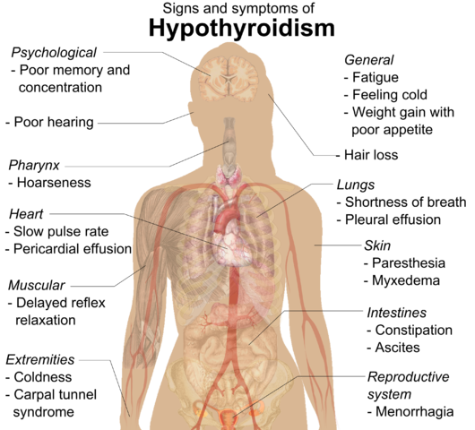 difference-between-hashimoto-and-hypothyroidism-difference-between