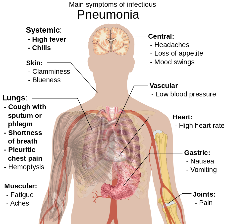 causes of pneumonia