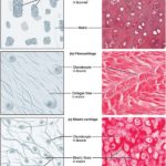 Difference Between Hyaline and Elastic Cartilage