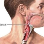 Difference between uvula and epiglottis-1