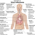 Difference between the Flu and Stomach Bug-1