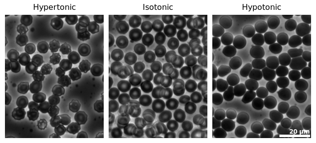 Difference Between Endosmosis and Exosmosis