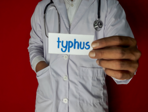 Difference Between Typhoid and Typhus | Difference Between | Typhoid vs ...